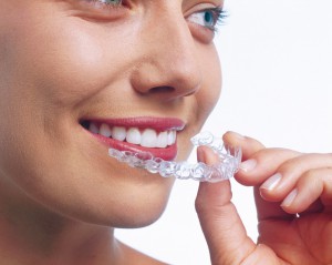 Frau mit Invisalign